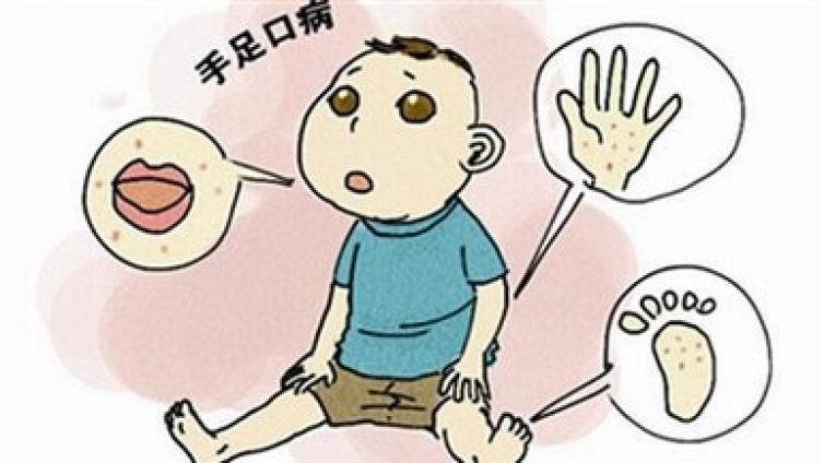 【课通学堂】对抗手足口应该掌握四个基本点