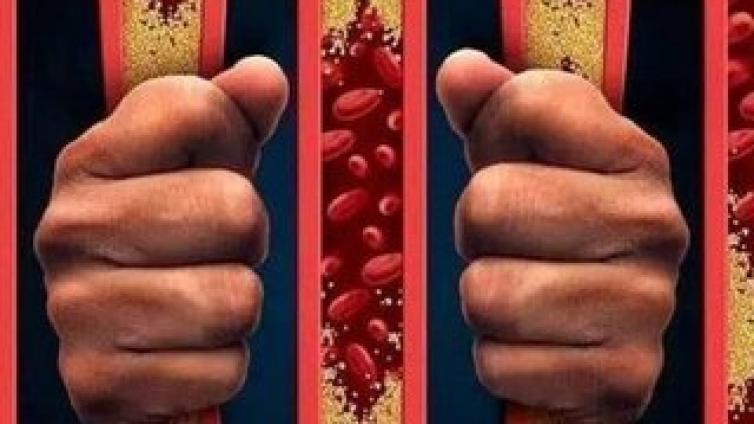 血管“堵”，先看脚！多“吃2黄、饮2水”，养护血管，远离血栓 
